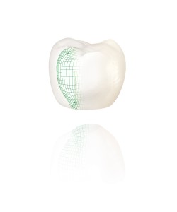 NobelProcera-all-ceramic-crown-for-natural-tooth-or-implant-